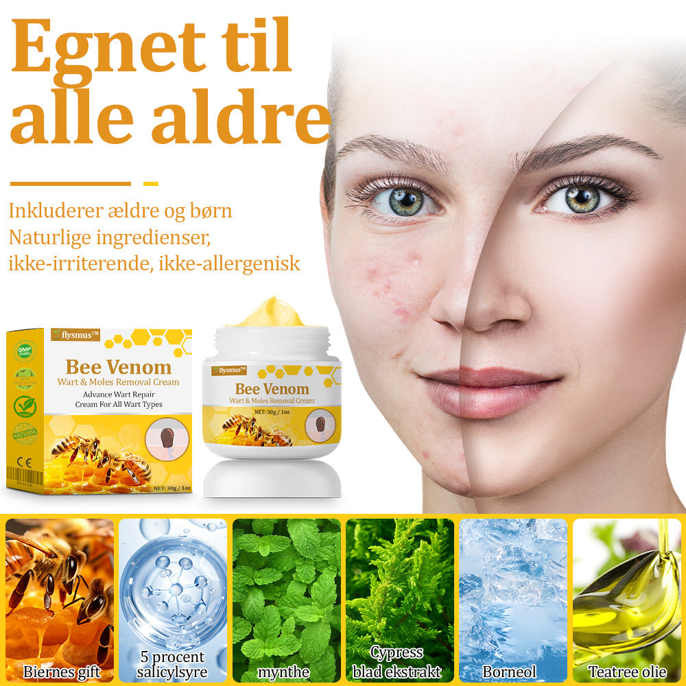 🐝 flysmus™ Starke Bienengiftcreme, zertifiziert von der Dänischen Dermatologischen Gesellschaft (DDS) - Hilft bei hartnäckigen Warzen, Hautwucherungen, Hautläsionen, Infektionen, Narbenbildung und gleicht Unebenheiten aus hud👨⚕️