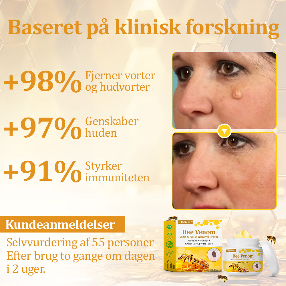 🐝 flysmus™ Starke Bienengiftcreme, zertifiziert von der Dänischen Dermatologischen Gesellschaft (DDS) - Hilft bei hartnäckigen Warzen, Hautwucherungen, Hautläsionen, Infektionen, Narbenbildung und gleicht Unebenheiten aus hud👨⚕️