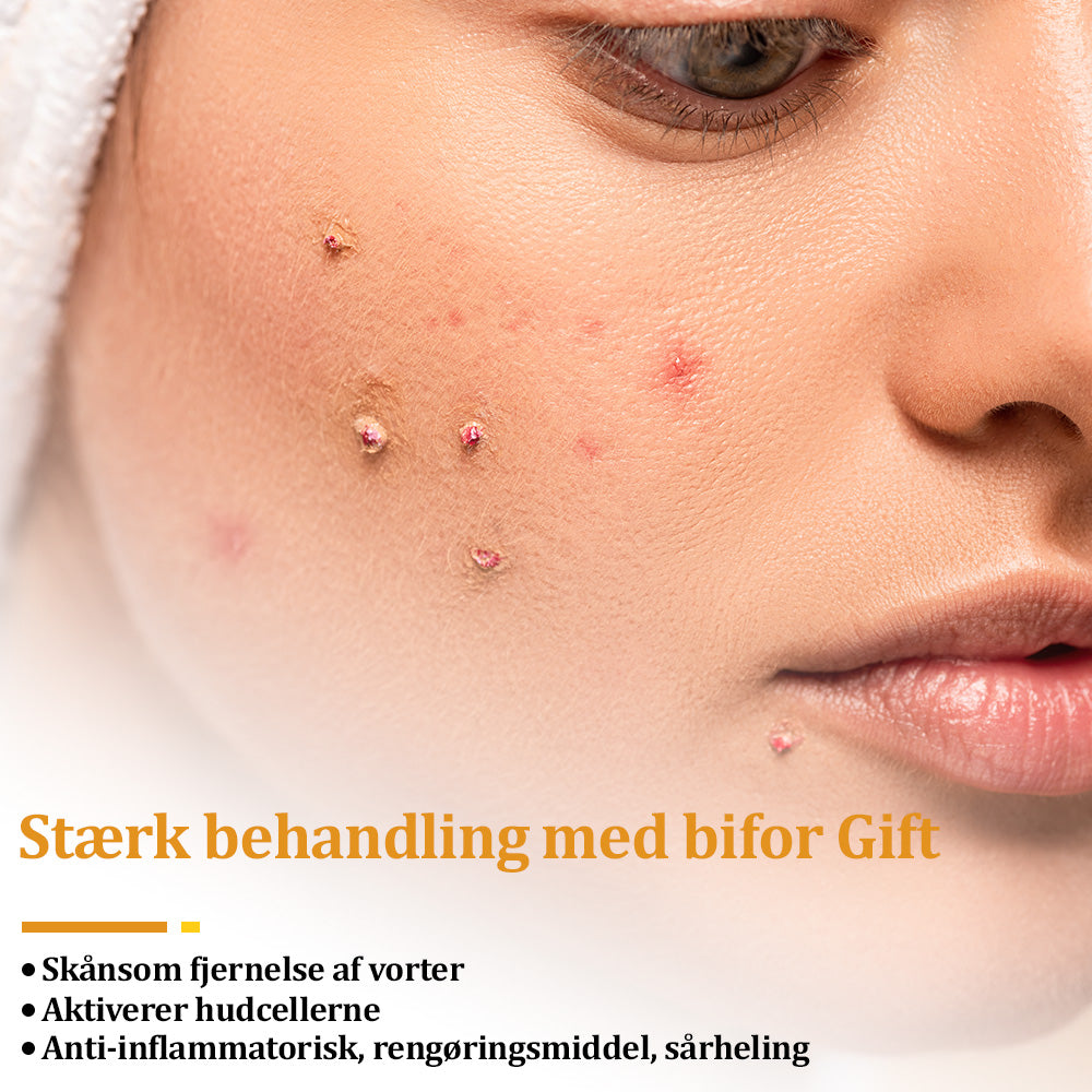 🐝 flysmus™ Starke Bienengiftcreme, zertifiziert von der Dänischen Dermatologischen Gesellschaft (DDS) - Hilft bei hartnäckigen Warzen, Hautwucherungen, Hautläsionen, Infektionen, Narbenbildung und gleicht Unebenheiten aus hud👨⚕️