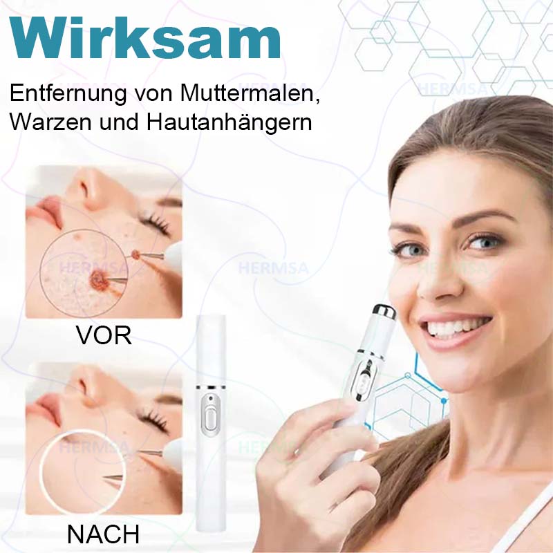 Hermsa® nicht-invasiver Laserpointer - Muttermal- und Warzenentfernung (🔥Letzter Tag 80% Rabatt)