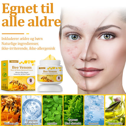 🐝 flysmus™ Starke Bienengiftcreme, zertifiziert von der Dänischen Dermatologischen Gesellschaft (DDS) - Hilft bei hartnäckigen Warzen, Hautwucherungen, Hautläsionen, Infektionen, Narbenbildung und gleicht Unebenheiten aus hud👨‍⚕️