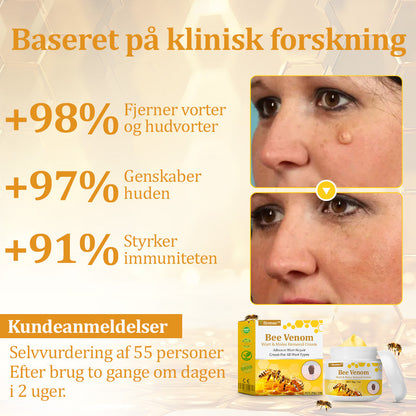 🐝 flysmus™ Starke Bienengiftcreme, zertifiziert von der Dänischen Dermatologischen Gesellschaft (DDS) - Hilft bei hartnäckigen Warzen, Hautwucherungen, Hautläsionen, Infektionen, Narbenbildung und gleicht Unebenheiten aus hud👨‍⚕️