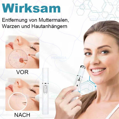Hermsa® nicht-invasiver Laserpointer - Muttermal- und Warzenentfernung (🔥Letzter Tag 80% Rabatt)